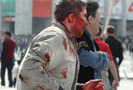 Число жертв произошедших 7 и 8 апреля в Бишкеке массовых беспорядков возросло до 79 человек. Минувшей ночью от полученных ранее ранений скончались еще три человека.