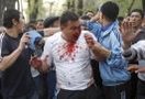 Жертвами беспорядков, которые накануне прокатились по столице Киргизии Бишкеку и пригородам города, стали три человека. Остальные получили ранения различной степени тяжести. Один из пострадавших находится в крайне тяжелом состоянии.